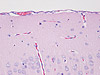 Cerebrum (40x) microscope adapter sample image