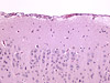Cerebrum microscope adapter sample image