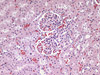 Kidney microscope adapter sample image