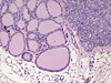Thyroid microscope adapter sample image